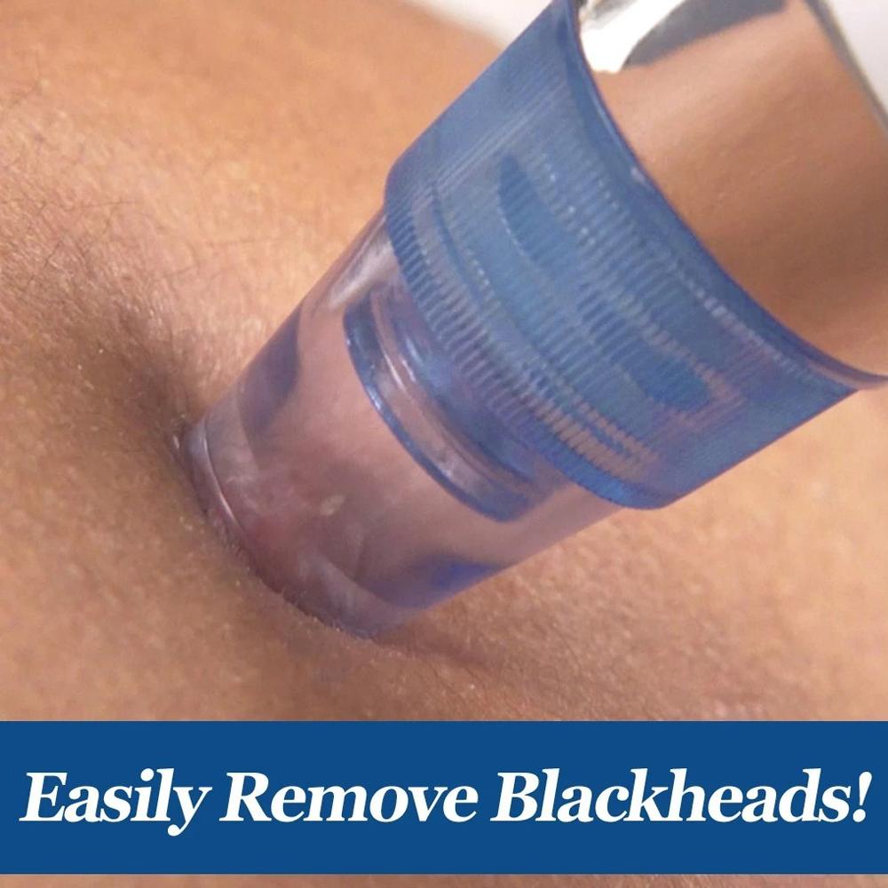 Components of the 4-in-1 blackhead extractor kit