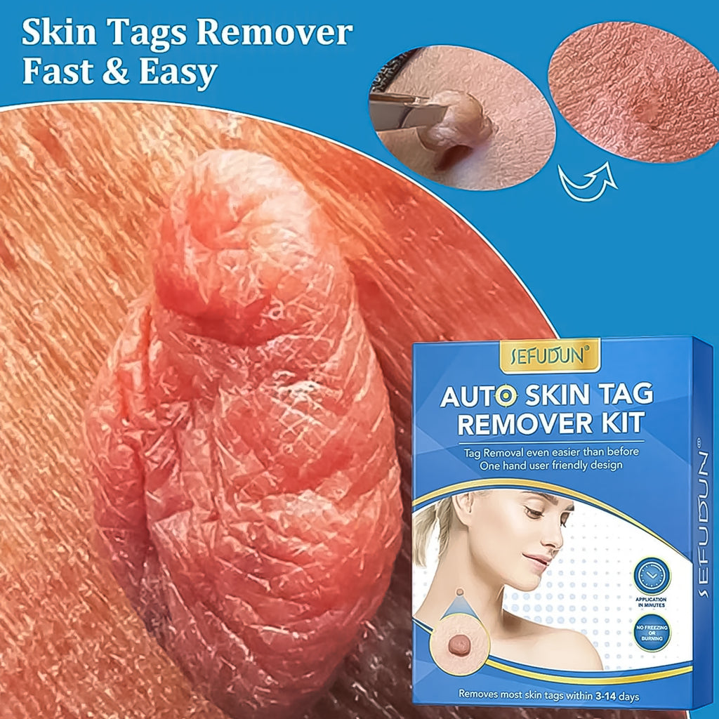 Comparison of micro (2-4mm) and large (4-8mm) rubber bands for the skin tag remover.