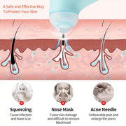 Diagram illustrating vacuum suction mechanism for skin cleaning